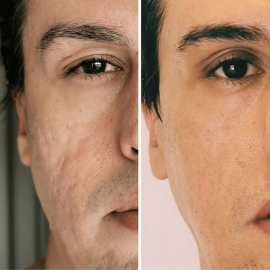 Meiskin Feminine Serum - Image 2