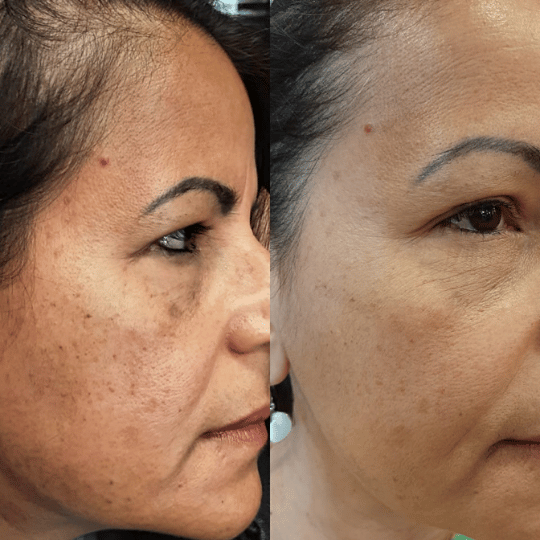 Meiskin Feminine Serum - Image 3