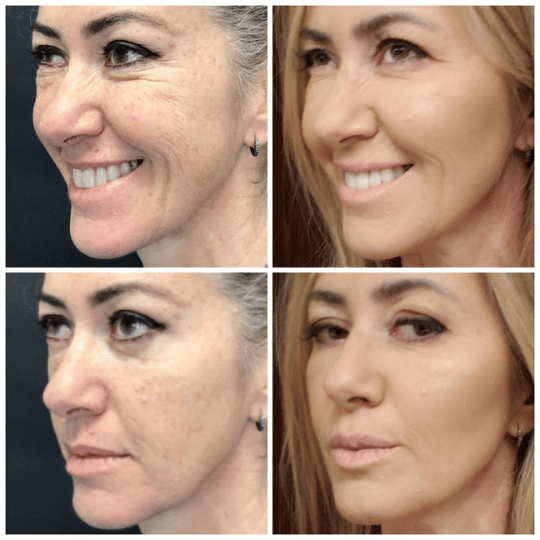 Meiskin Feminine Serum - Image 4