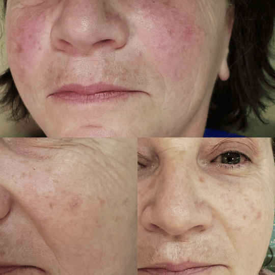 Meiskin Feminine Serum - Image 5