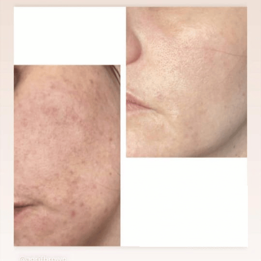 Meiskin Feminine Serum - Image 6