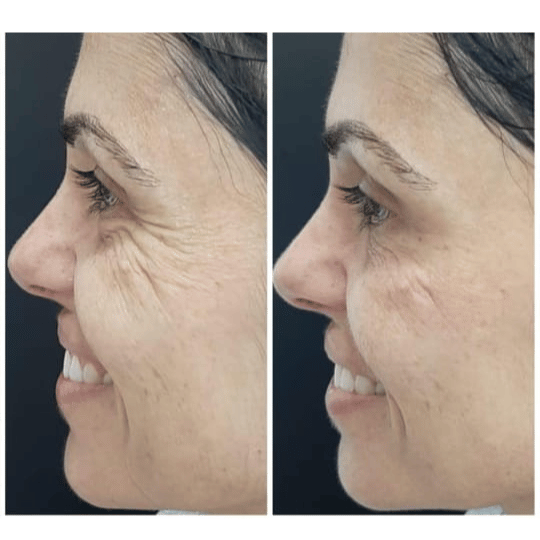 Meiskin Feminine Serum - Image 7