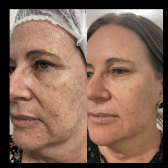 Meiskin Feminine Serum - Image 8